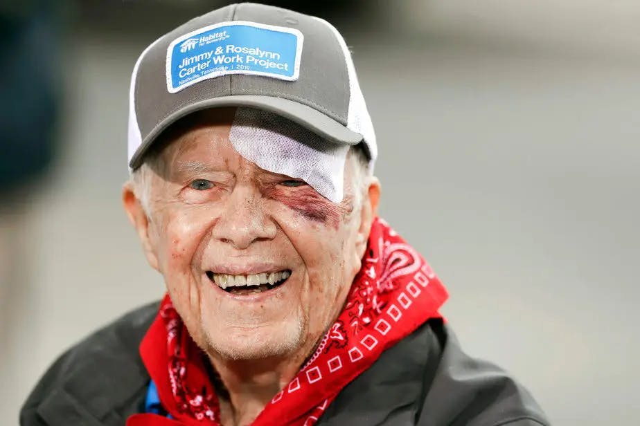 Former US President: Jimmy Carter with a scar on his eye
