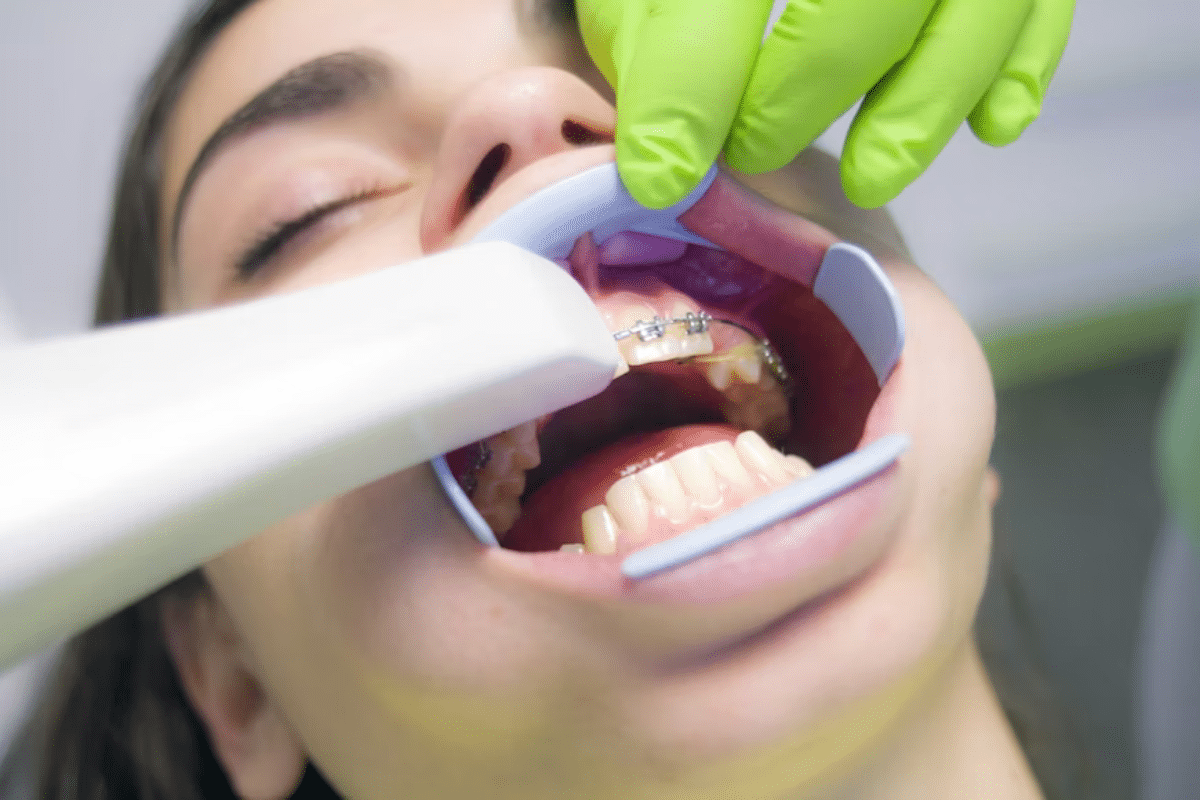 dental insurance braces coverage canada